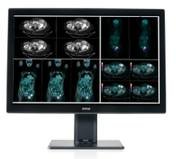 Coronis Fusion 4MP 30" · con cubierta · Barco