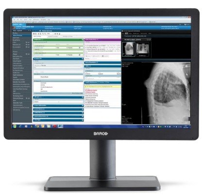 Eonis Color 2MP 24" · monitor clínico · Barco