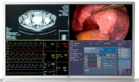 Monitor de cirugía 55" 4K · MDSC-8255 · Barco