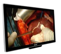 Monitor de cirugía 27" 4K · MDSC-8527 · Barco