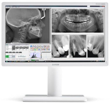 Nio Color 2MP · dental · Barco