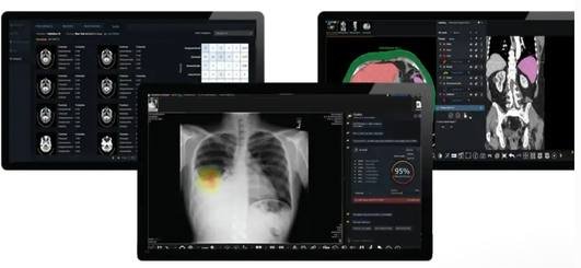PaxeraRIS + PaxeraUltima PACS VNA · PaxeraHealth