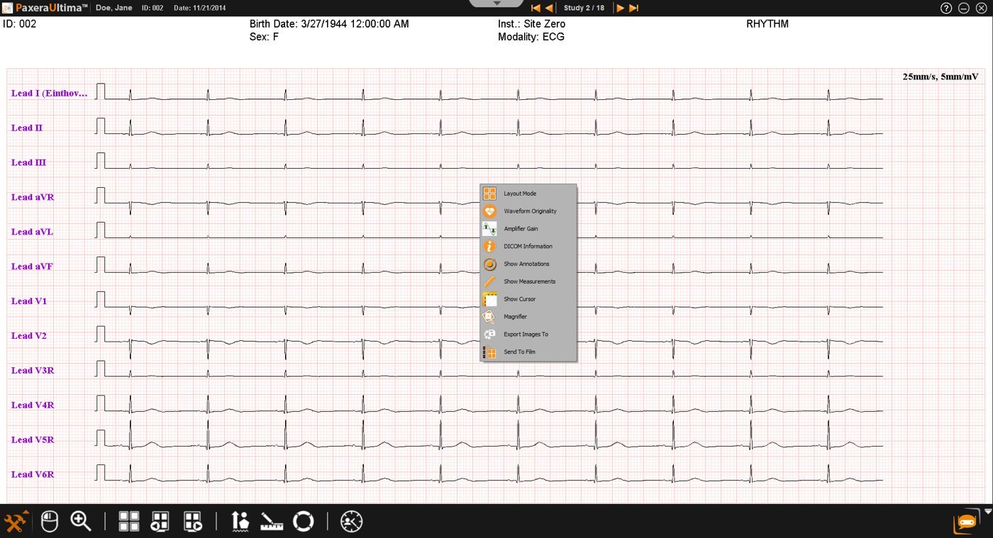 Módulo de cardiología: ECG